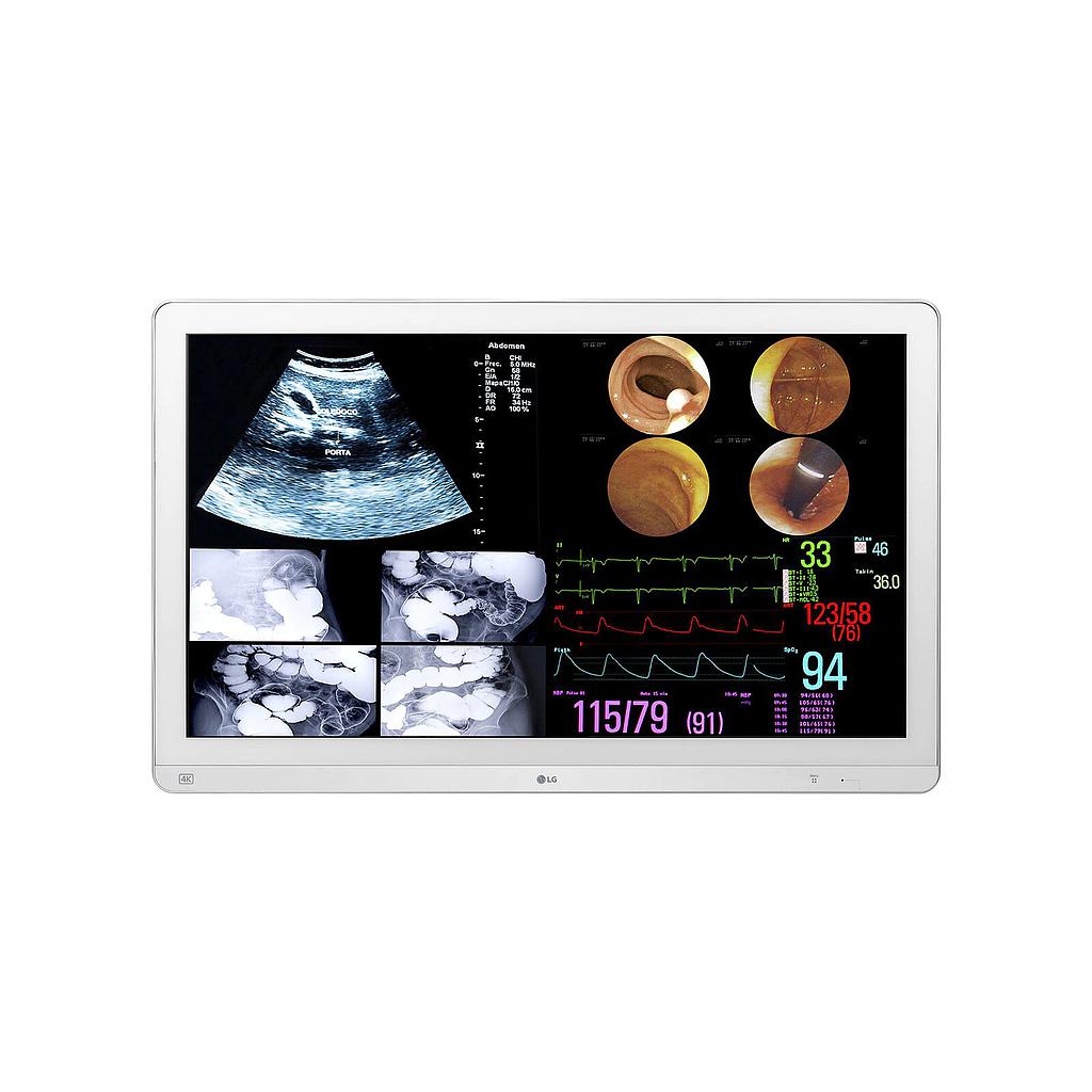32HL714S-W Monitor Quirúrgico 32" 8MP